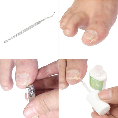 Herramienta Para Pedicura De Uñas De Los Pies 12 Delineador