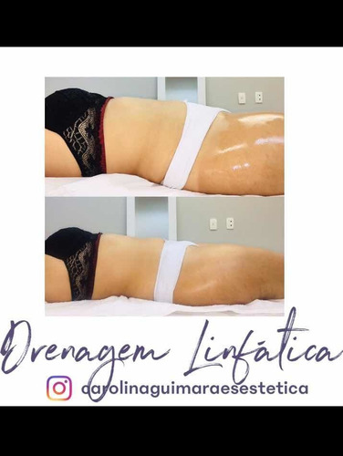 Imagem 1 de 1 de Drenagem Linfática