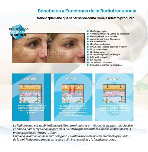 Imagen 9 de 10 de Radiofrecuencia Multipolar Facial Corporal 150w Profesional.