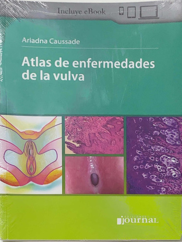 Caussade Atlas De Enfermedades De La Vulva Nuevo Envíos