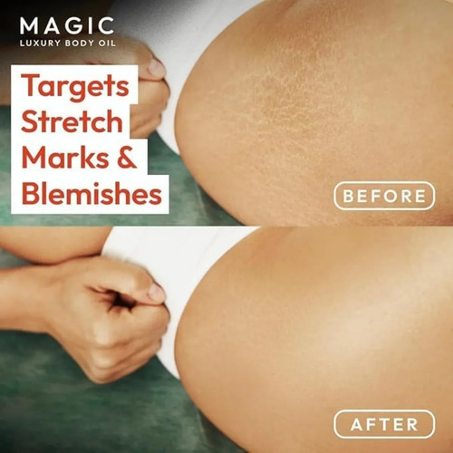 Aceite Reafirmante Magic Body, Aceite Corporal Para Después