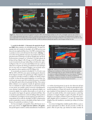 Ultrasonido Vascular. Ecografía En Modo B, Doppler Color Dup