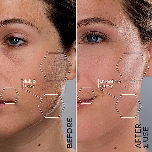 Michael Todd Beauty - Sonicsmooth - Herramienta De Dermaplan