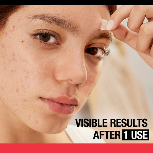 Skincare Parches Neutrogena Para Disminución De Acné 24 Pzs