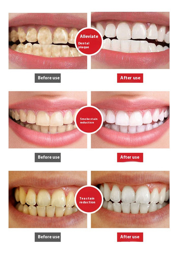 Pasta De Dientes Fresh Breath Para Blanquear Los Dientes, 5