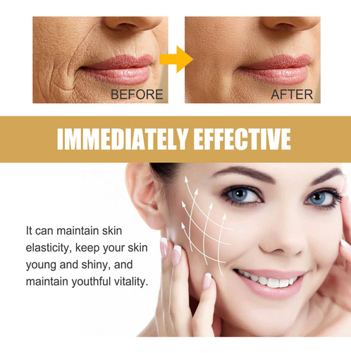 Parche Q Con Retinol Para El Área Nasolabial, Parches Para E