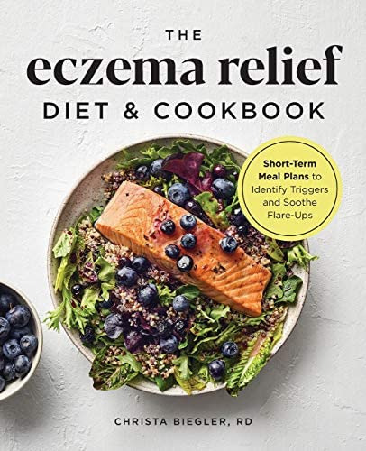 The Eczema Relief Diet & Cookbook : Short-term Meal Plans To Identify Triggers And Soothe Flare-ups, De Rd  Christa Biegler. Editorial Rockridge Press, Tapa Blanda En Inglés
