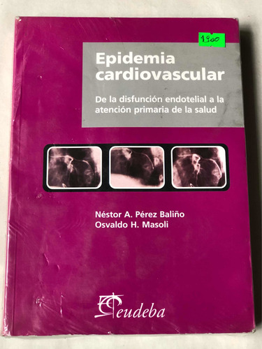 Epidemia Cardiovascular = Baliño Y Masoli