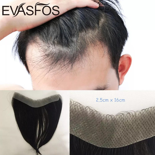 Peluquín New Front Para Hombre, 100% Humano, Para Hombre