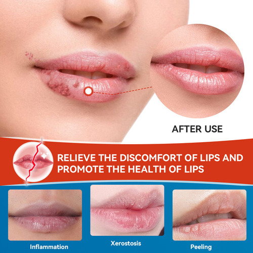 Bálsamo Labial Cicatrizante Para Lábios Secos E Rachados Par