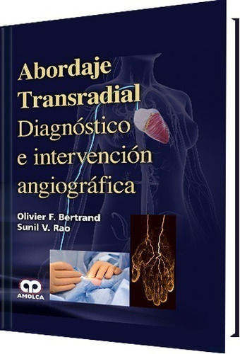 Abordaje Transradial Diagnóstico E Intervención Angiográfica