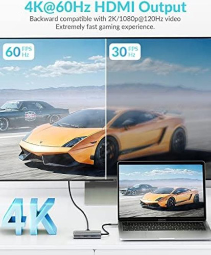 Phixero Hub Usb C: Adaptador Multipuerto Estación Versátil