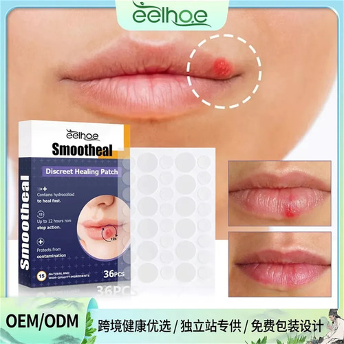 2 Parches Útiles Para Aliviar El Herpes Labial Y Curar La Di