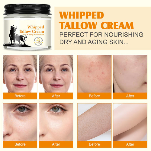 D Beef Tallow Balm Nourishes Moisturizes And Tightens T 7005