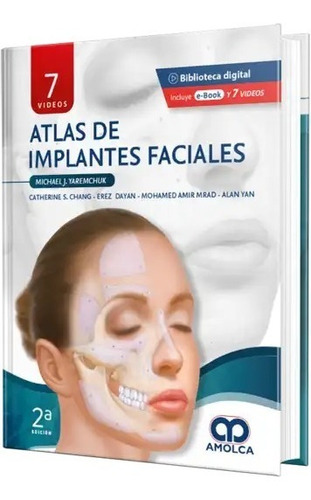 Atlas De Implantes Faciales 2a Edición