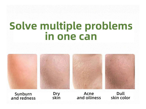 Q Aloe Gel Aloe Gel Produtos Para Cuidados Com A Pele Hydrat