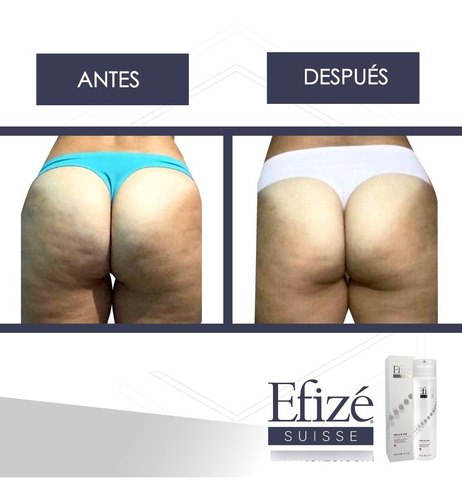 Imagen 3 de 4 de Cell'a Vie De Efizé Suisse ® - Tratamiento Anti-celulitico