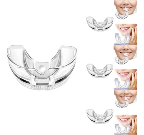 Frenillos Removible Trainer Adultos Plan Completo Alineador