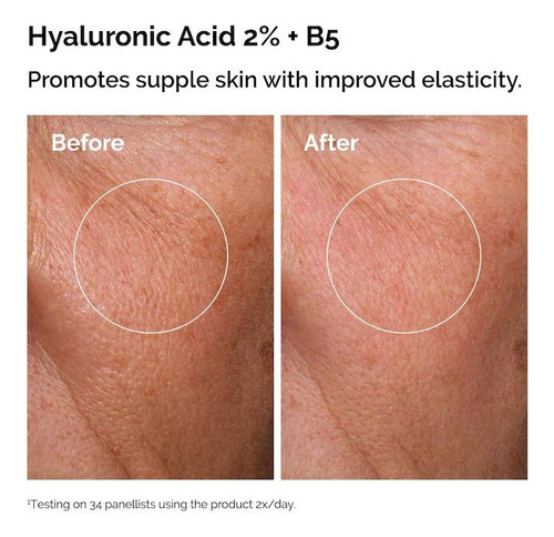 The Ordinary The Skin Support Set With Niacinamide + Hyaluro Todo Tipo De Piel Día/noche