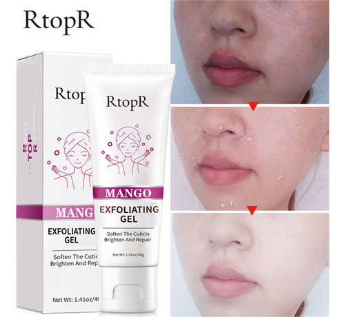 Crema De Gel Exfoliante En V, Exfoliante Facial, Crema Facia
