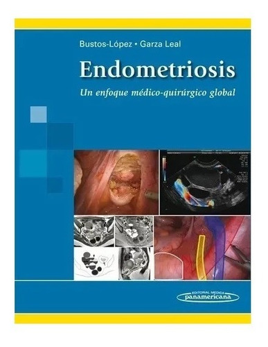Endometriosis Un Eoque Medico Quirurgico Global !
