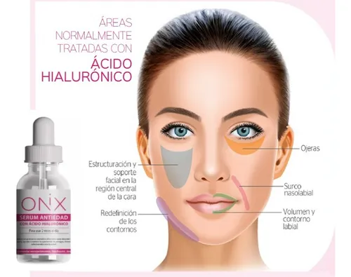 Ácido Hialurónico Onix *2 - mL a $1583