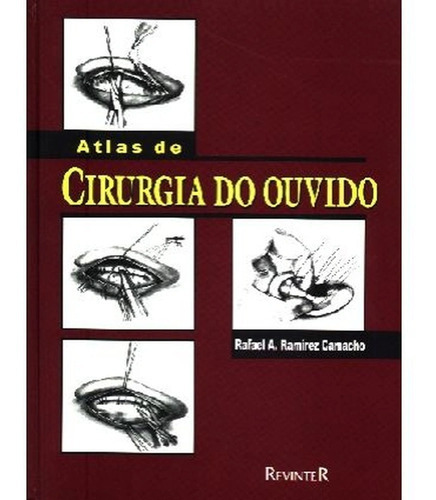 Atlas De Cirurgia De Ouvido, De Rafael A. Ramirez Camacho. Editora Revinter, Capa Dura, Edição 1 Em Português