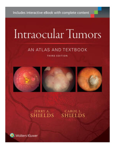 Intraocular Tumors 3ed - Outlet