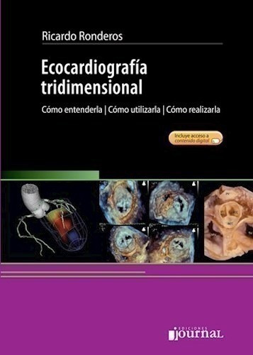 Ecocardiografía Tridimensional - Ronderos, Ricardo (papel)