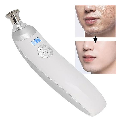 Microdermoabrasión Portátil Inalámbrico, Recargable. Tienda