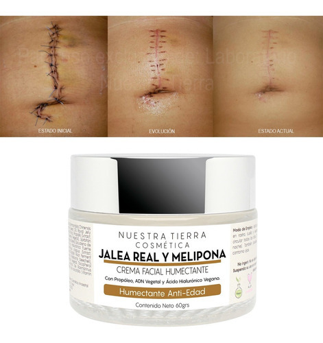 Imagen 2 de 7 de Crema Humectante-cicatrizante Anti-edad Jalea Real Melipona Tipo De Piel Todo Tipo De Piel