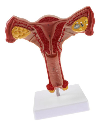 Útero Femenino Humano 1:1, Ovario, Trompas De Falopio, Model