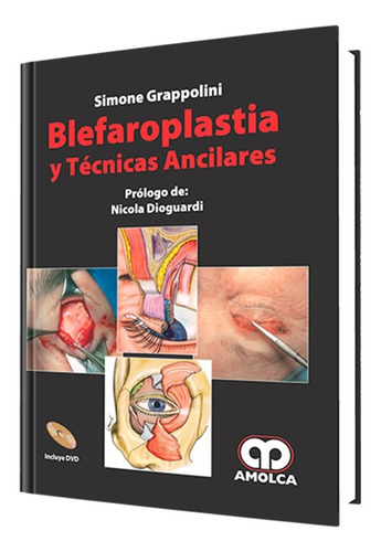 Blefaroplastia Y Técnicas Ancilares. Libro De Medicina.