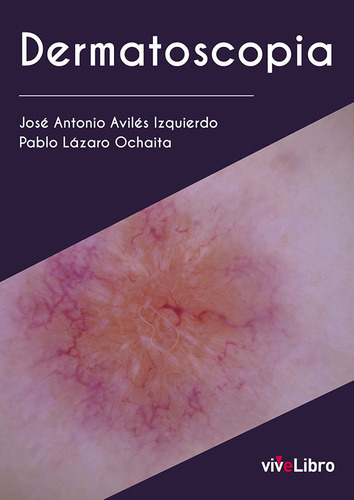 Dermatoscopia, De Lazaro Ochaita, Pablo. Editorial Vivelibro, Tapa Blanda En Español