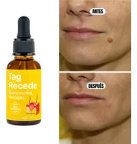 Comprar Tag Recede Verrugas Y Lunares Tratamiento Natural Efectivo