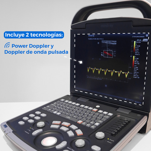 Ultrasonido Humano Transductor Convexo y Lineal Dp30CL Mindray