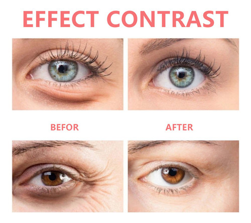 Creme De Olhos Retinol Para Clarear, Hidratar E Reduzir O Es