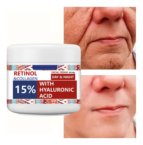 Creme Diurno E Noturno De 50 G De Retinol - Rosto Levemente