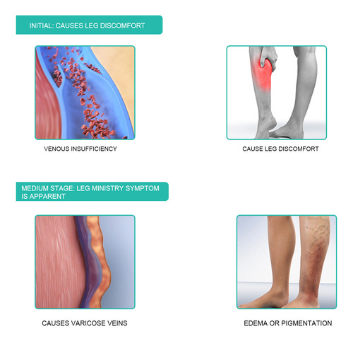 Medias De Compresión Elásticas Médicas Para Venas Varicosas