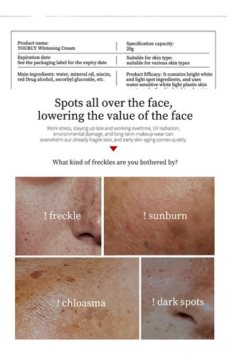 Fy Crema Antipecas, Blanqueadora Y Rejuvenecedora De La Piel