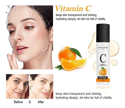 Suero Vitamina C Aclarante Anti Acné Limpia Humecta Tu Piel