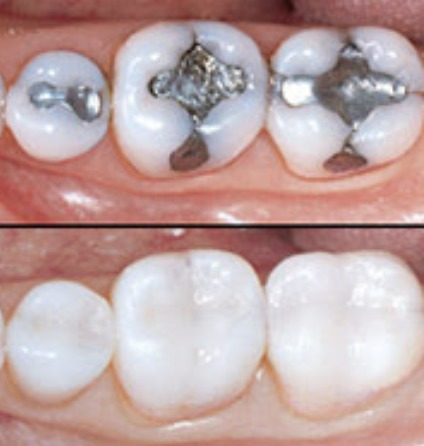 Imagen 2 de 5 de Dentista-odontólogo/limpieza De Sarro
