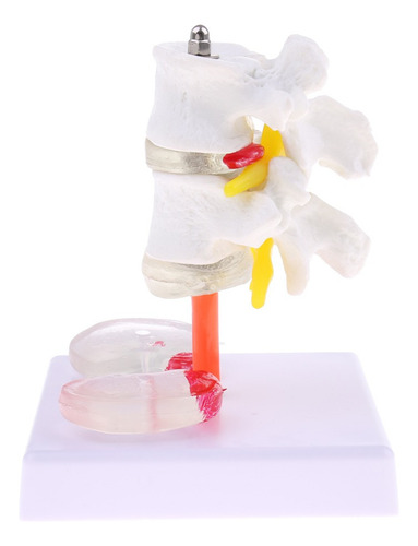 Vértebra Lombar Da Coluna Vertebral Humana 1: 1 Com Modelo