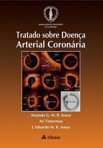 Tratado Sobre Doença Arterial Coronária, De Timerman, Ari. Editora Atheneu, Capa Mole, Edição 1ª Edição - 2017 Em Português