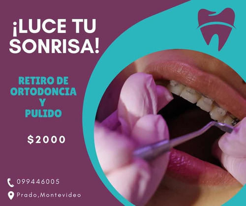 Imagen 2 de 5 de Limpieza Dental Completa, Consultorio Dental