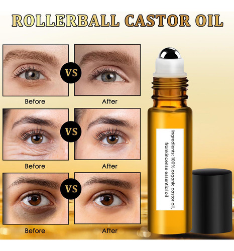 O Roll Castor And Eye Eraser Under Eye Rollerball Erase 8005