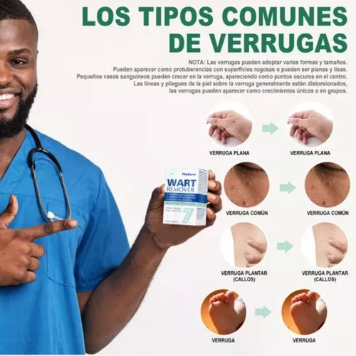 Tratamiento Para Eliminar Las Verrugas Causadas Por El Vph (