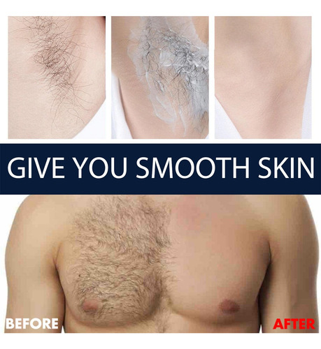 Creme De Remoção De Pelos-remoção De Pelos Indolor Para