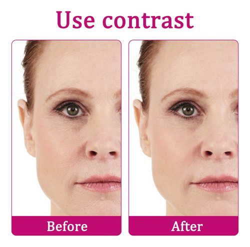 An Um Creme Facial Hialurônico E Retinol Que Descolora