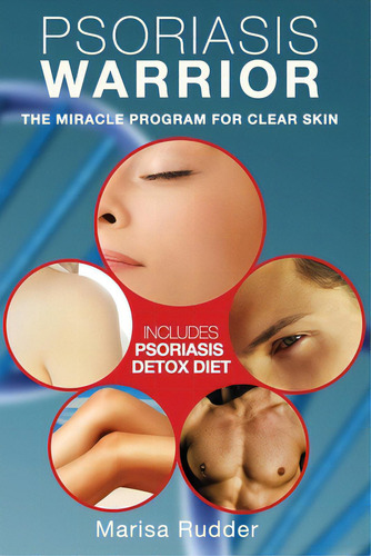 Psoriasis Warrior: The Miracle Program For Clear Skin: The Miracle Program For Clear Skin, De Rudder, Marissa., Vol. 1. Editorial Lightning Source Inc, Tapa Blanda En Inglés